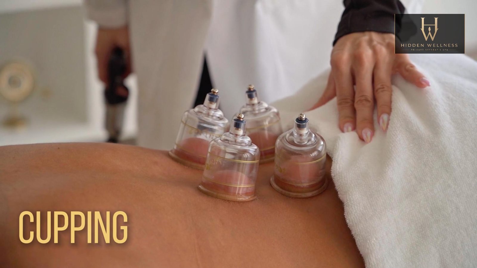Cupping